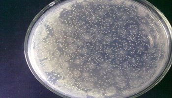 每个能够生长繁殖的细菌细胞都可以在平板上形成一个可见的菌落