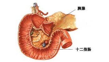 胰腺类癌