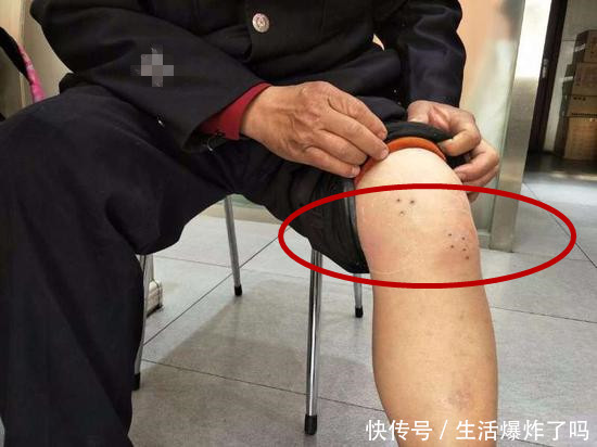 男子腿疼了三年，去医院检查后，才知道自己多么无知