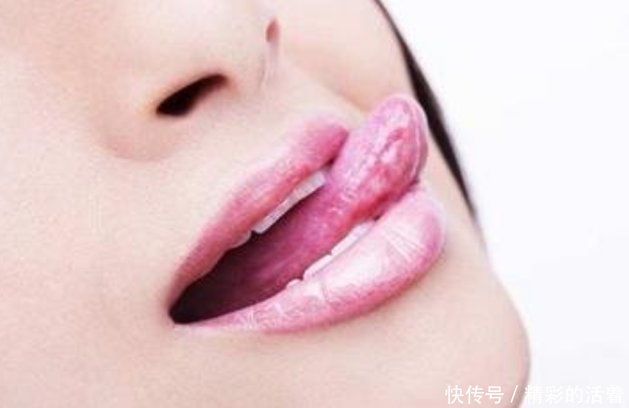 若舌头出现这2种现象,可能是食管病变的前兆