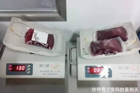 婴儿脐带血的真实作用实在太大,多数父母选择