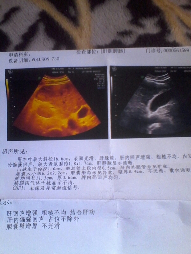 什么情况下要做腹部ct t01176b7fce64ecd685.jpg