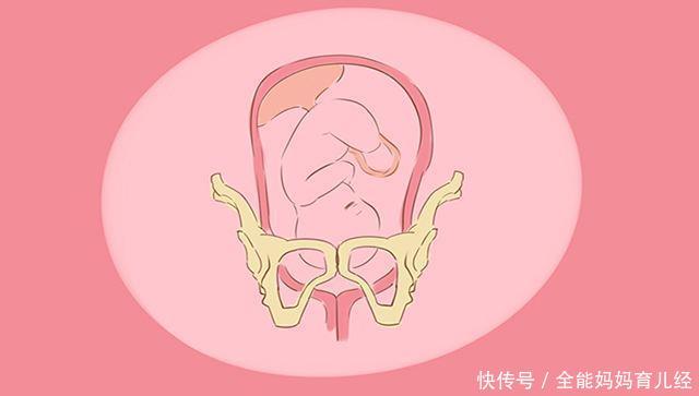 孕晚期胎宝宝入盆是怎样的体验?出现这5种感