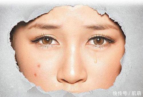 皮肤管理丨健康皮肤的测评标准~你的皮肤健康吗?