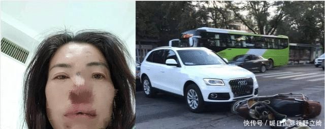 头被撞后多久确认没事