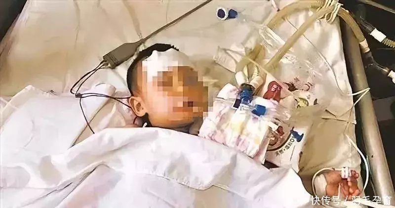 1岁孩子偷喝了一口这个,马上抽搐口吐白沫,此