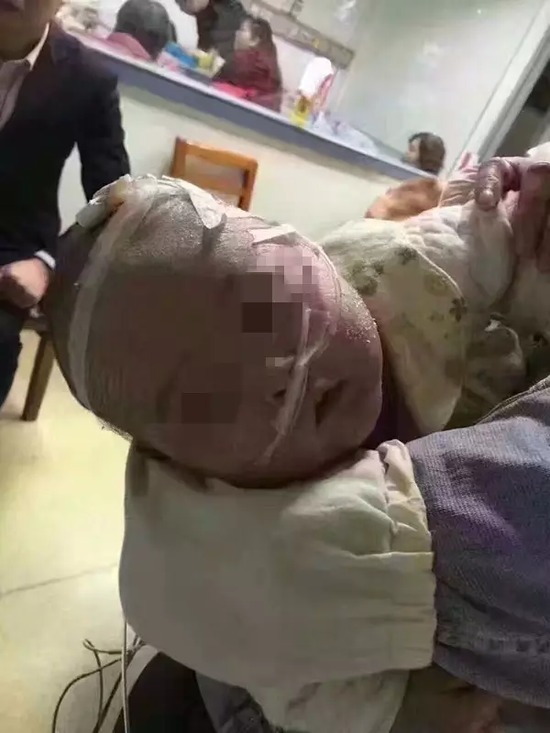 【转】北京时间 5个月男婴被下病危通知书 母亲网上求粪便救命 - 妙康居士 - 妙康居士~晴樵雪读的博客 【转】北京时间 5个月男婴被下病危通知书 母亲网上求粪便救命 - 妙康居士 - 妙康居士~晴樵雪读的博客