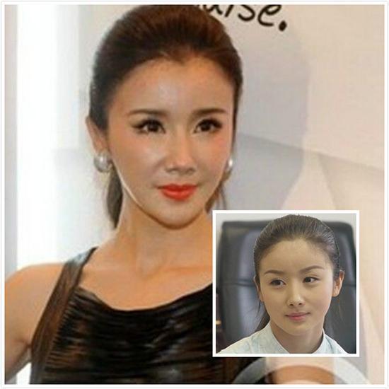 因整容而毁容吓人的明星,因整容而毁容吓人的明星有哪些