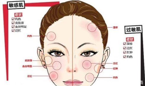 护肤知识 敏感肌与过敏肌的区别
