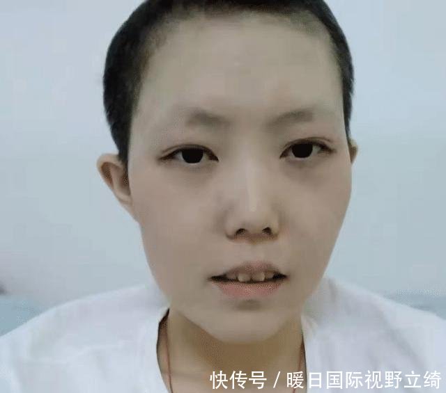 头被撞后多久确认没事