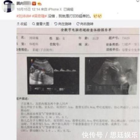 刘诗诗预产期将近, 48岁吴奇隆获双胞胎, 网友