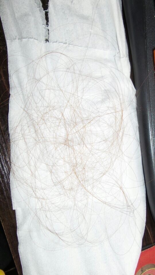 <em>掉头发</em>很严重,四年了,以前<em>手术</em>过后就一直<em>掉头</em>