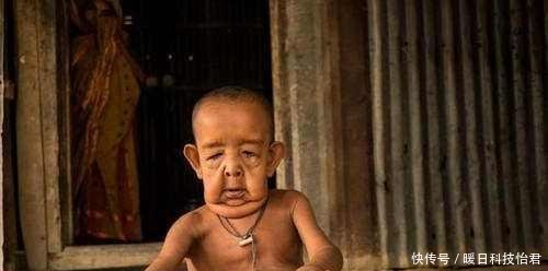 近亲结婚的后果到底有什么后果来看看日本皇