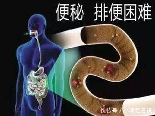 一般多少岁会得痔疮 t016e0af3962f3e4b09.jpg?size=320x240