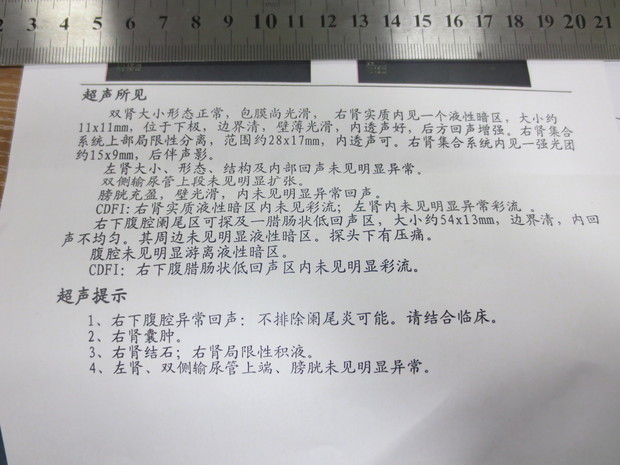 肚子右下腹挤压有疼痛感,医院检查结果是急性