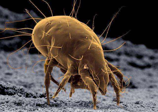 冬天再冷,也不要忘记勤晒被,螨虫365天都要防