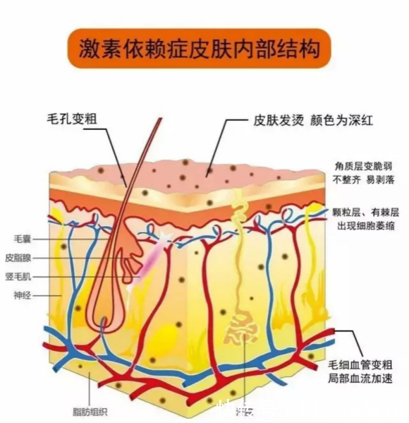 激素脸修复用什么方法,激素脸怎么治疗修复