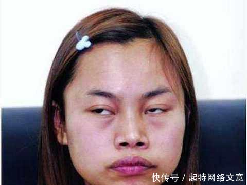 凤姐用自己的照片证明换头手术的成功, 刷新了