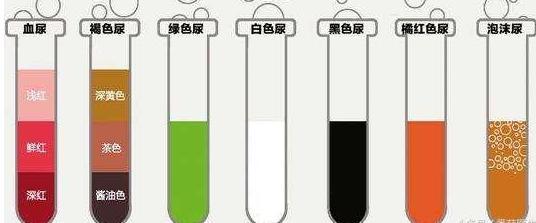 排尿很黄,异味很大,是身体的什么信号吗?