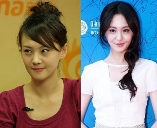 娱乐圈那些大方承认整容的女明星们，戚薇坦荡，郑爽可惜，而她算是整残了