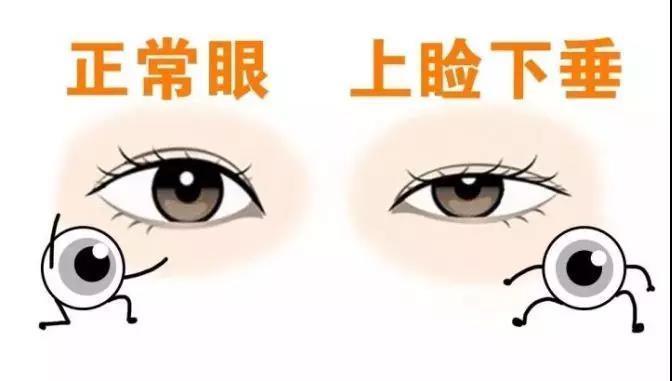 矫正视力算多少,矫正视力多少算正常