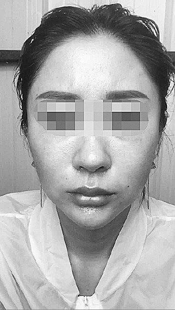 女子为了追星,去整容,整过之后后悔不巳。