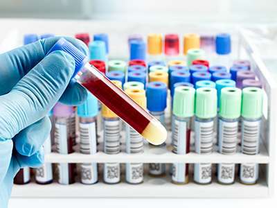 血常规检查可以查出癌症吗?还能检查出什么?