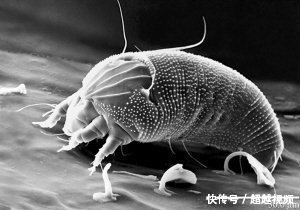 床上用品需要除螨虫吗?