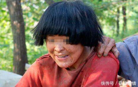 老婆突然得病成了傻子，我受不了和她离婚，一年后看见她我傻了