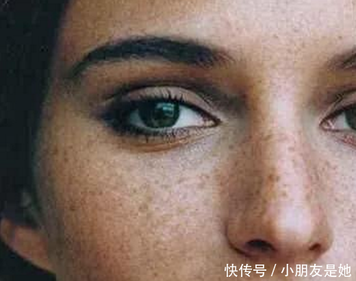 平时生活中,能够帮助淡斑的4个土办法,记好了