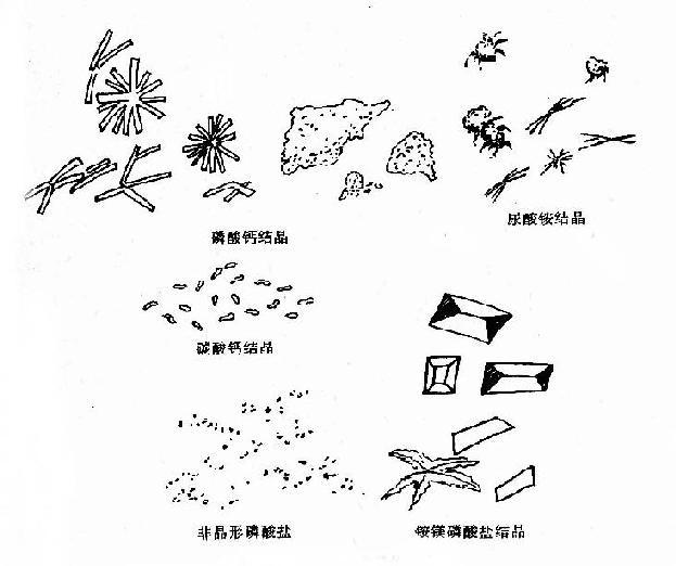 简介 磷酸盐类结晶(phosphaticcrystals)包括无定形磷酸盐,磷酸镁铵