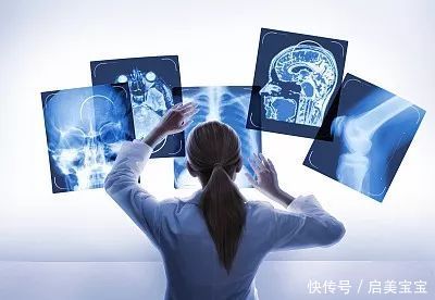 日本体检中必不可少的MRI(磁共振成像),究竟是