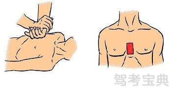 下图所示为胸外心脏按压法的正确做法。_360