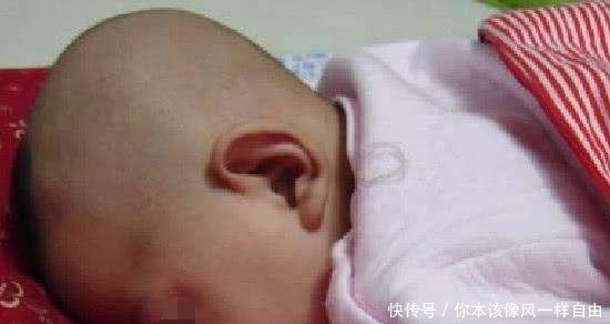 1岁宝宝感染疱疹病毒患上脑膜炎,不幸离世,家