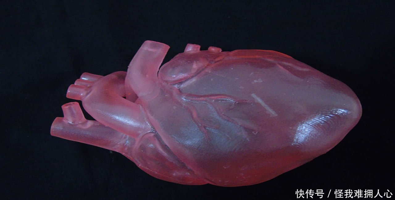 心脏病患者有救了,世界首个3D打印心脏诞生,能