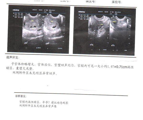 怀孕去医院做b超检查不知道是否健康正常_36