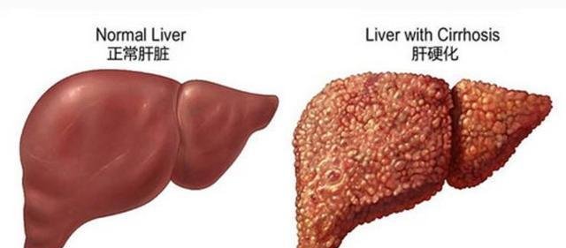 足浴大亨年产值曾达13亿, 如今网上众筹治病