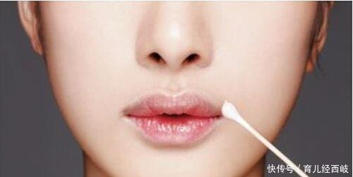 孕妇嘴唇干裂可以用润唇膏吗 孕妇用什么润唇