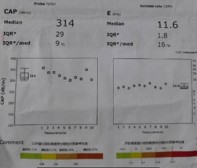 手把手教你如何诊断脂肪肝?