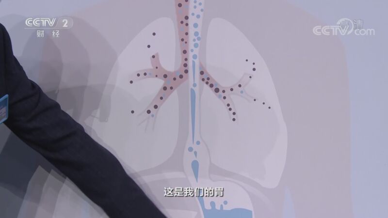 职场健康课 《职场健康课》 20201101 伪装者——百变胃食管反流