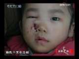 健康之路 铅笔之祸