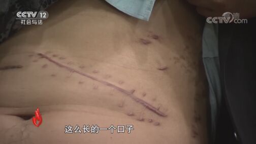 道德观察 《道德观察(日播版)》 20200814 挥向爱人的折叠刀