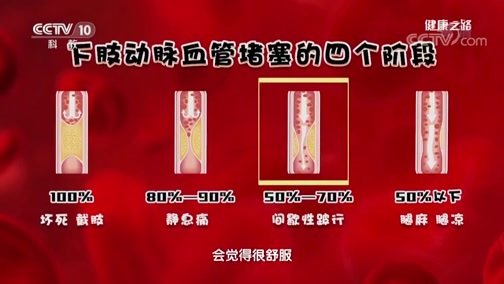 健康之路 《健康之路》 20190615 血管病了真要命（三）