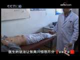 健康之路 腹中“炸弹”