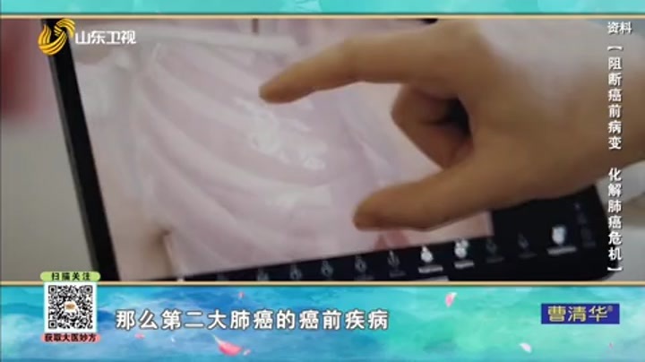 大医本草堂 阻断癌前病变 化解肺癌危机
