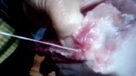 播报多看点 猪肉寄生虫 小心啤酒瓶爆炸