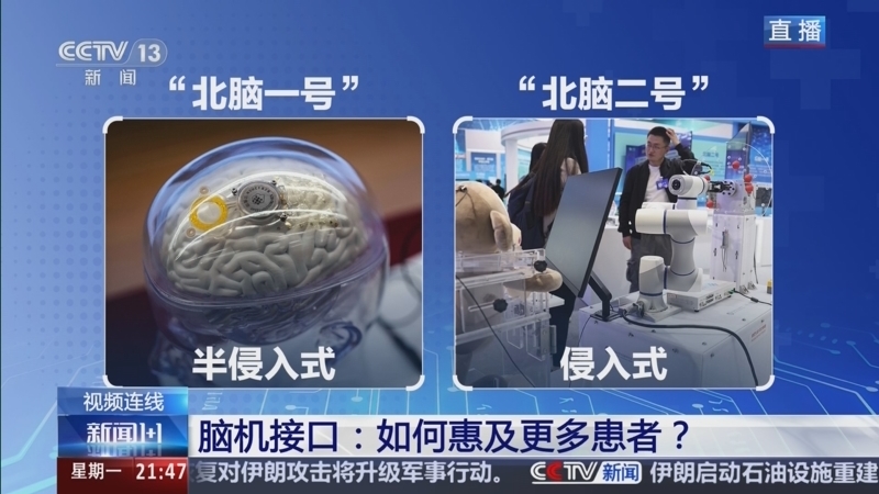 《新闻1+1》 20260413 脑机接口：如何惠及更多患者？