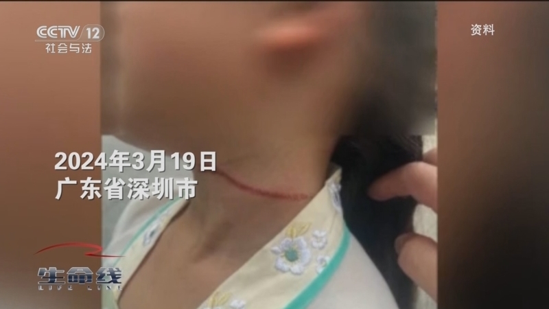 生命线 《生命线》 20240524