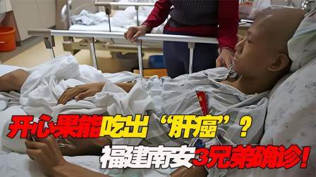 品人生百味第二季 开心果能吃出“肝癌”，福建南安3兄弟确诊肝癌！眼珠都变黄了