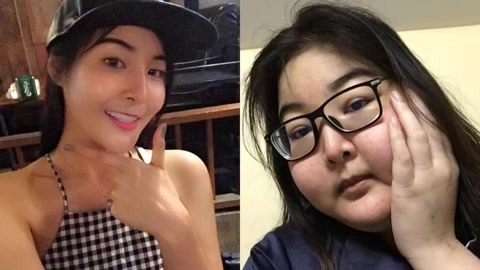 网罗天下 美女患怪病暴肥两倍晒照